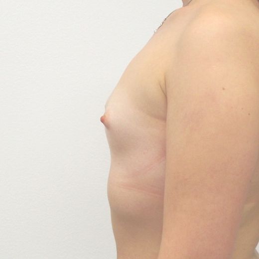 Image before