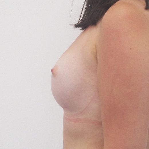 Image after