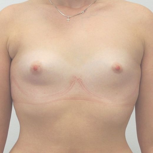 Image before