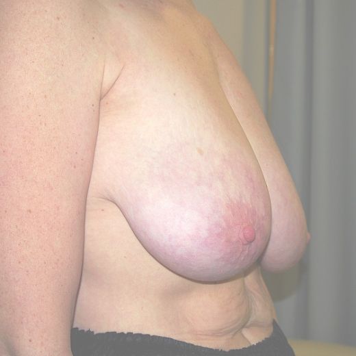 Image before