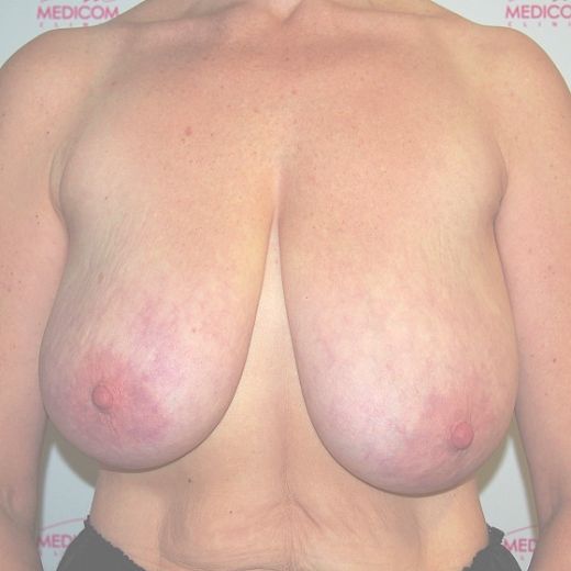 Image before