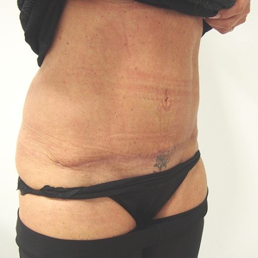 Image after