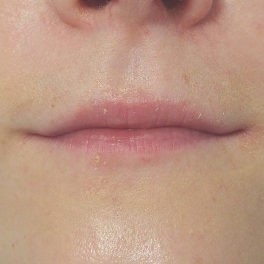 Image before