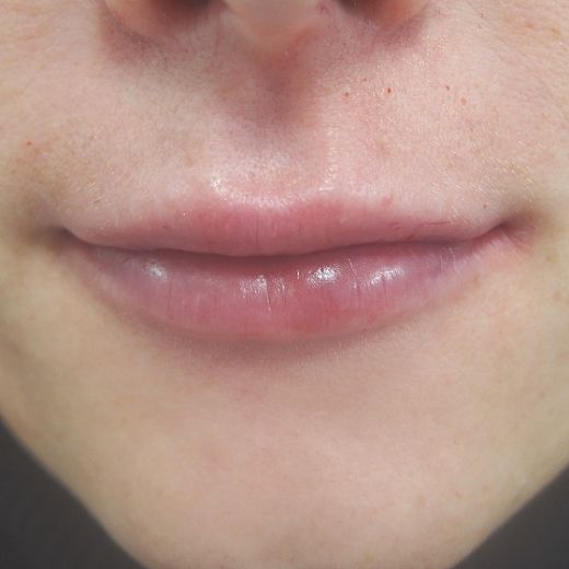 Image after