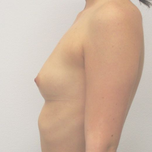 Image before