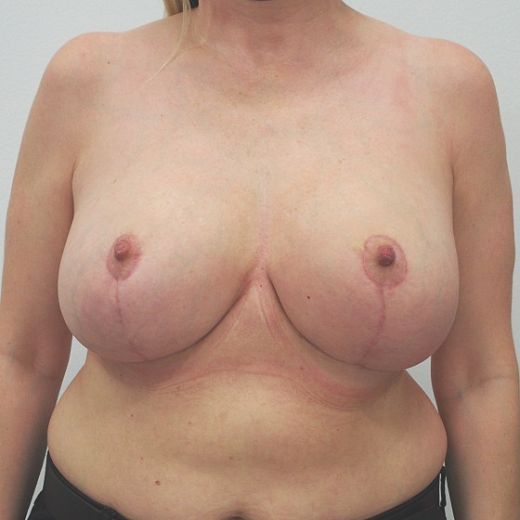 Image after