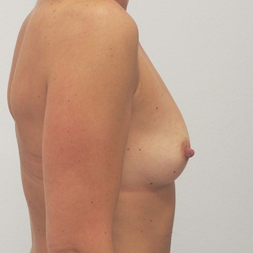 Image before