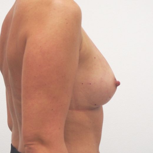 Image after