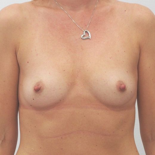 Image before