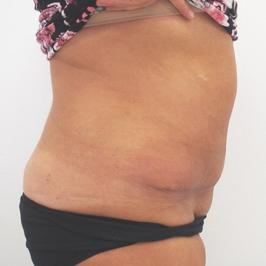 Image after