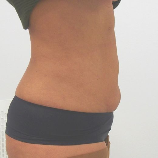 Image after