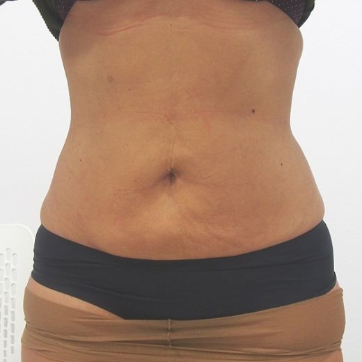 Image after