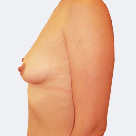 Image before