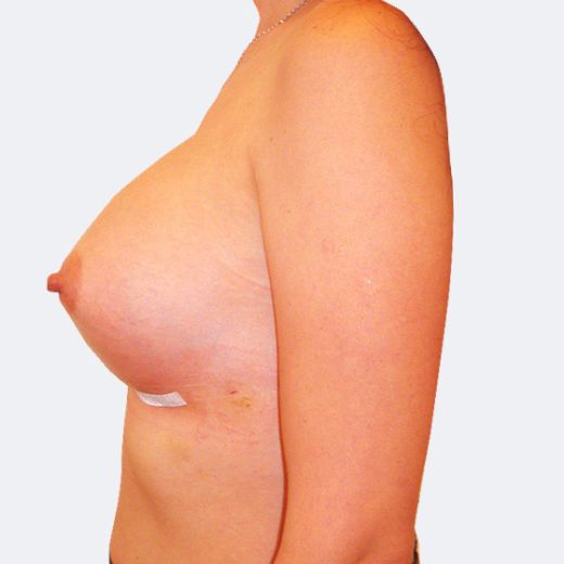Image after