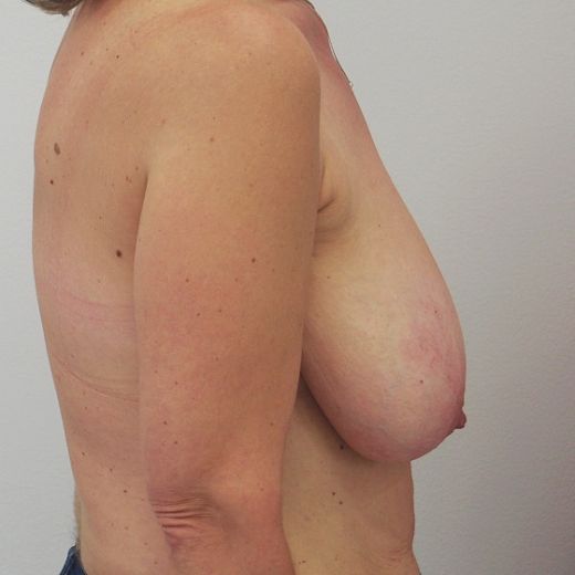 Image before