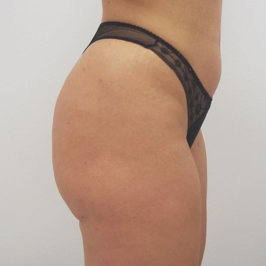 Image after