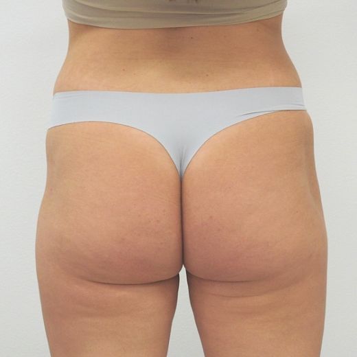 Image before