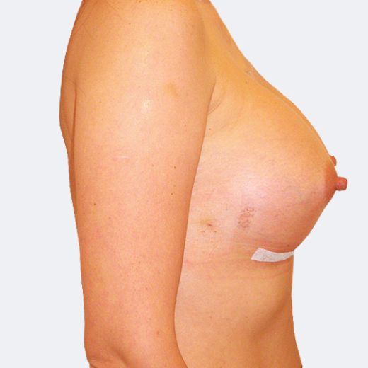 Image after