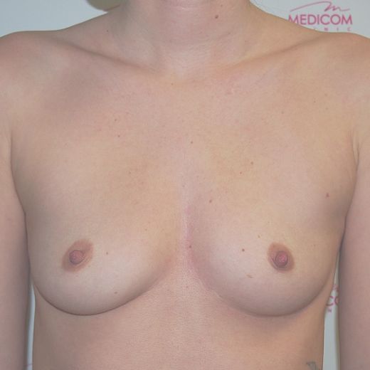 Image before