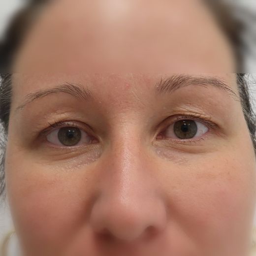Image before