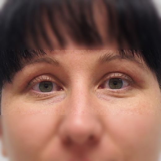 Image after