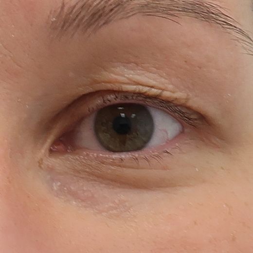 Image before