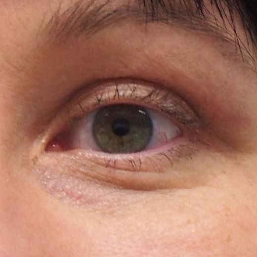 Image after