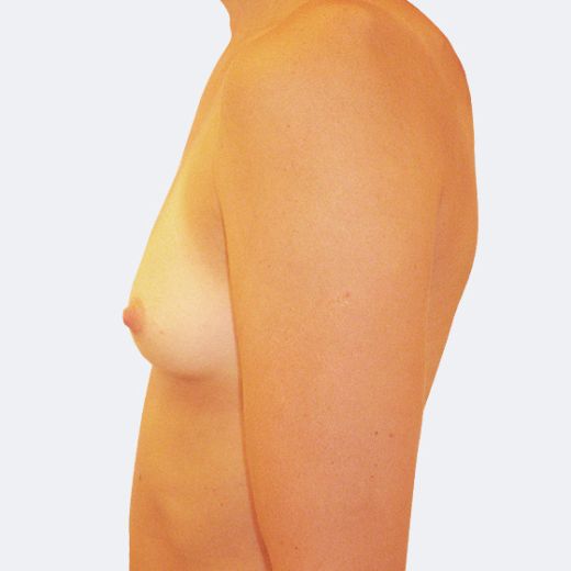 Image before