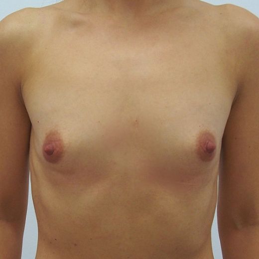 Image before