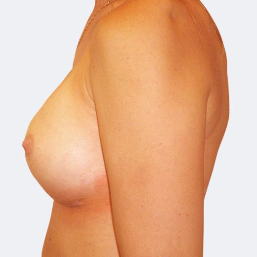 Image after