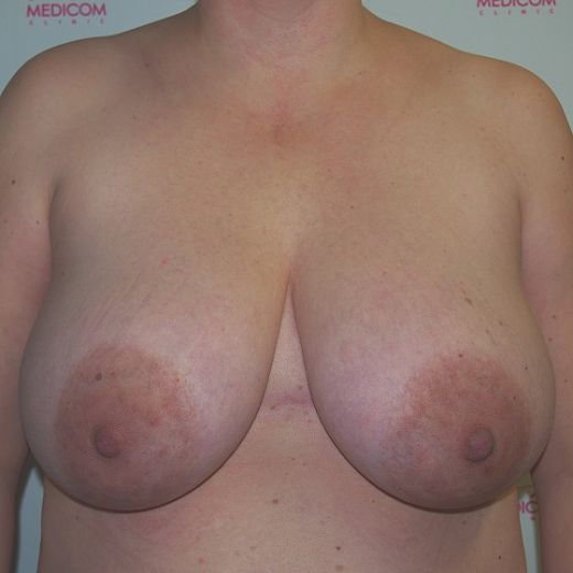 Image before