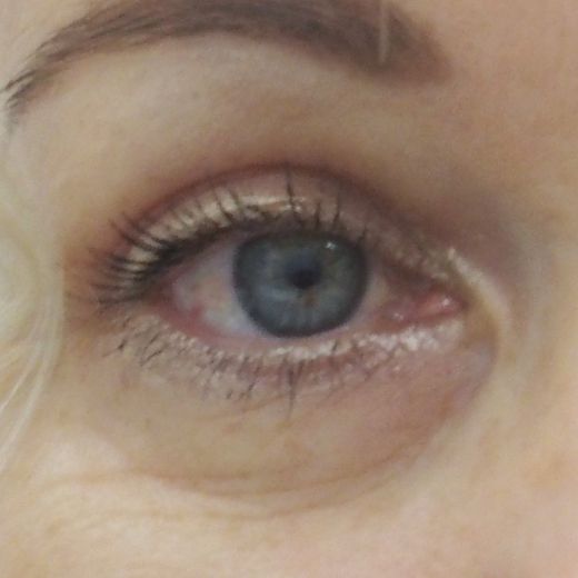 Image after