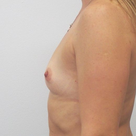 Image before