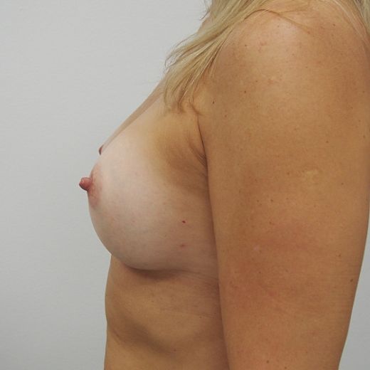 Image after