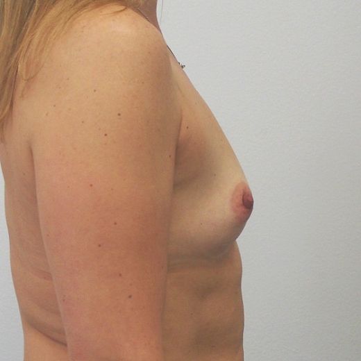 Image before