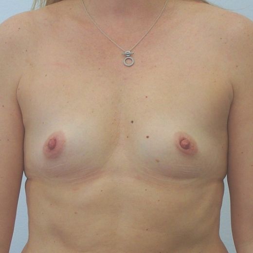 Image before