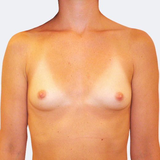 Image before
