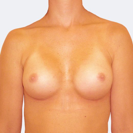 Image after