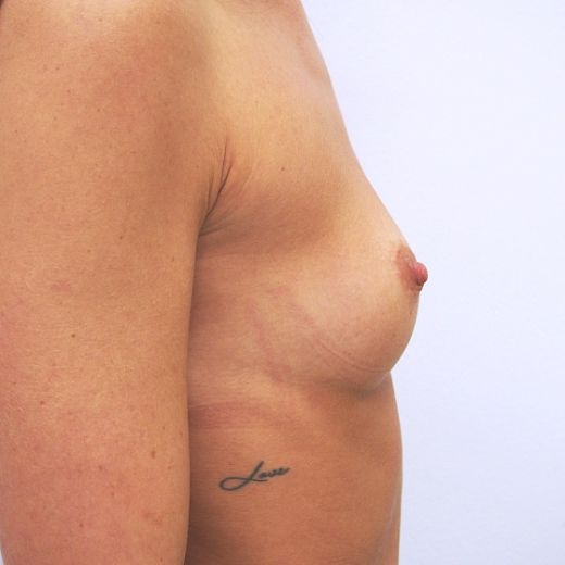 Image before