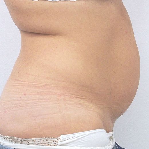 Image before