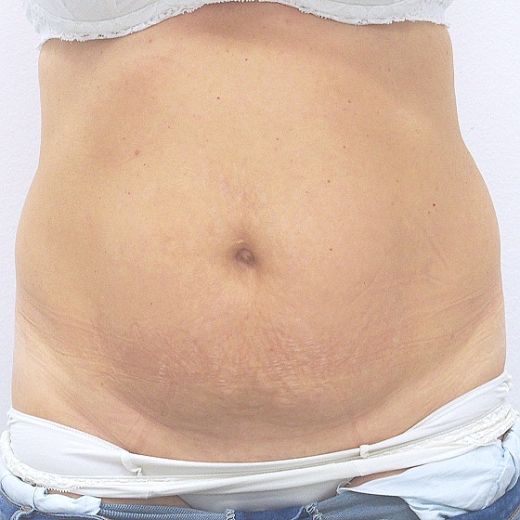 Image before