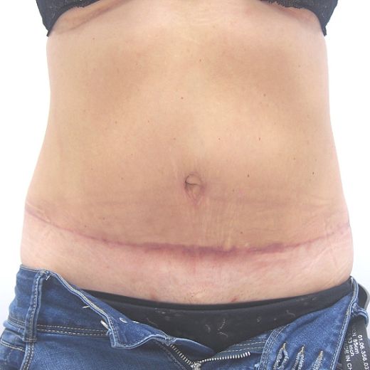 Image after