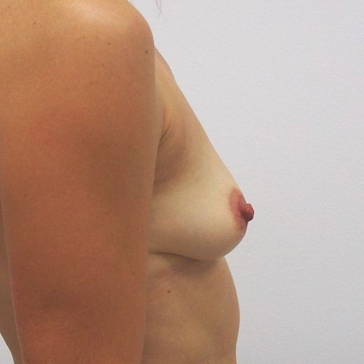 Image before