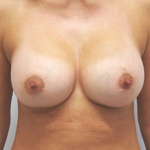 Image after