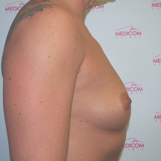 Image before