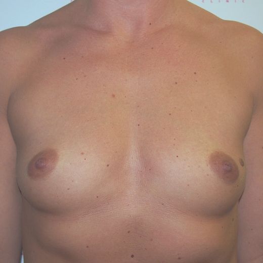 Image before
