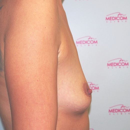 Image before