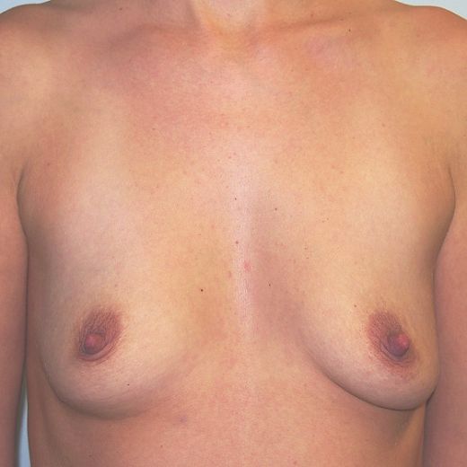 Image before
