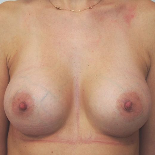Image after