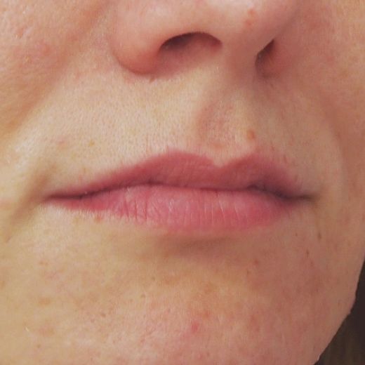 Image before